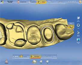 Cabinet Dentaire Damien Labonde et Quentin Dantan - Process Cerec